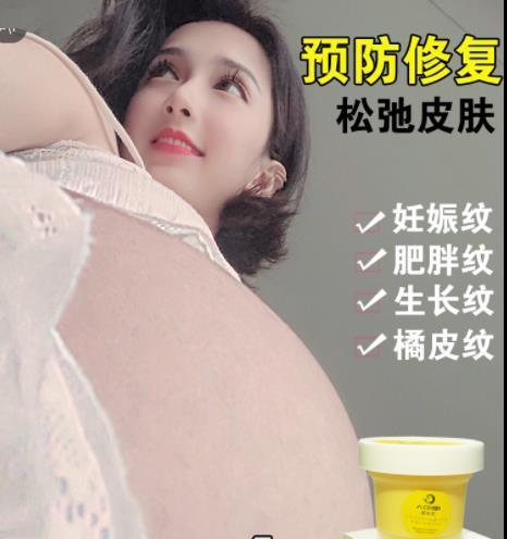 消除妊娠纹的有效方法（告别妊娠纹）