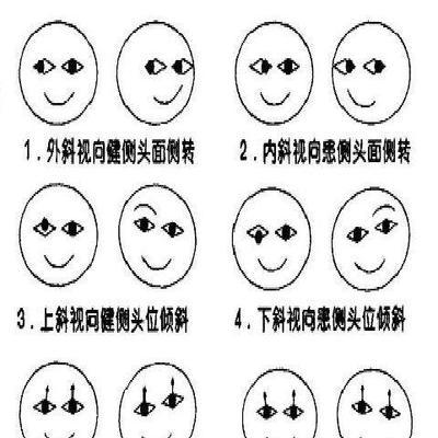 深入探讨导致斜视的原因（解析斜视发生的关键因素及防治方法）