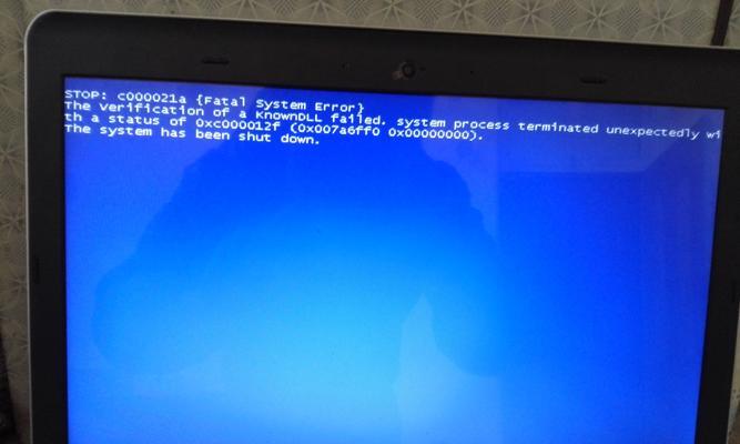笔记本蓝屏了修复办法（解决笔记本蓝屏问题的有效方法）