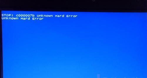 解决0x0000007b蓝屏的方法（通过修复0x0000007b错误解决蓝屏问题）