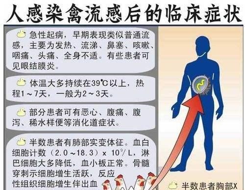 禽流感如何预防？掌握预防知识和措施是什么？