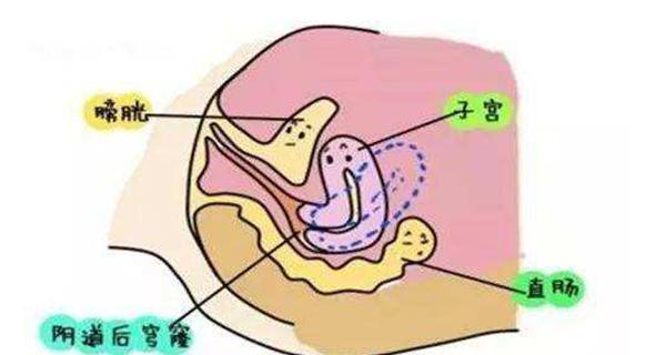 子宫后位如何提高受孕率？有效方法有哪些？